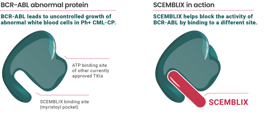 BCR-ABL abnormal protein. BCR- ABL leads to uncontrolled growth of abnormal white blood cells in Ph+ CML-CP. ATP binding site of other currently approved TKIs. SCEMBLIX binding site (myristoyl pocket). SCEMBLIX in action. SCEMBLIX helps block the activity of BCR-ABL by binding to a different site. SCEMBLIX binding site
